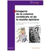 Elsevier Masson Imagerie de la colonne vertébrale et de la moelle épinière