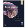 Elsevier Masson Neuro-imagerie