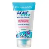 Dermacol Acne Clear gel nettoyant pour peaux à problèmes, acné 150 ml
