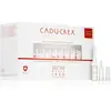 CADU-CREX Hair Loss HSSC Serious Hair Loss cure capillaire pour femme ...