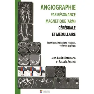 Comparateur de prix : Sauramps Medical Angiographie par resonance magnetique (arm) cerebrale et medullaire