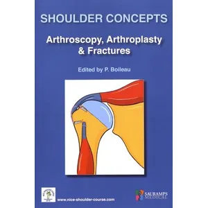 Comparateur de prix : Sauramps Medical Shoulder concepts arthroscopy arthrosplasty & fractures