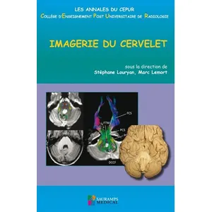 Sauramps Medical Imagerie du cervelet pas cher