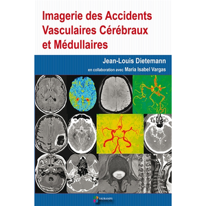 Comparateur de prix : Sauramps Medical Imagerie des accidents vasculaires cerebraux et medullaires