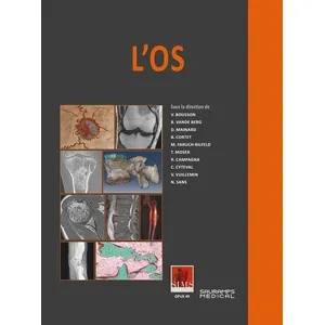 Comparateur de prix : Sauramps Medical L'os - SIMS Valérie Bousson (Auteur), (Société d'Imagerie Musculo-Squeletique) SIMS (Auteur)