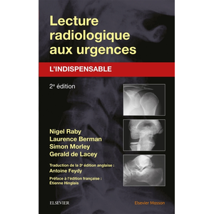 Elsevier Masson Lecture radiologique aux urgences : l'indispensable