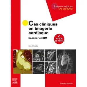 Elsevier Masson Cas cliniques en imagerie cardiaque pas cher