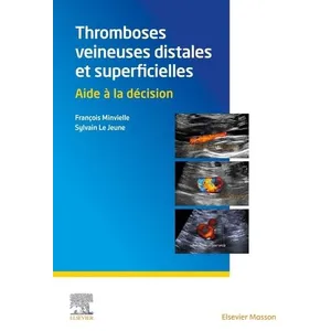 Elsevier Masson Thromboses veineuses distales et superficielles pas cher