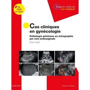 Elsevier Masson Cas cliniques en imagerie : gynécologie pas cher