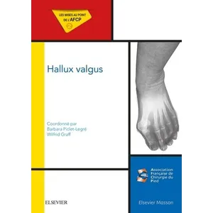 Elsevier Masson Hallux valgus pas cher
