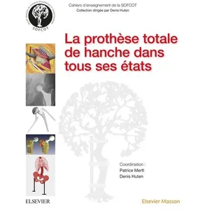Comparateur de prix : Elsevier Masson La prothèse totale de hanche dans tous ses états