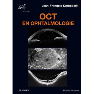 Comparateur de prix : Elsevier Masson OCT en ophtalmologie