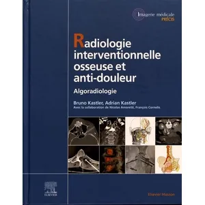 Comparateur de prix : Elsevier Masson Radiologie Interventionnelle osseuse et anti-douleur