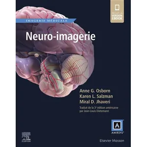 Comparateur de prix : Elsevier Masson Neuro-imagerie