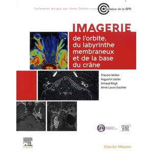 Comparateur de prix : Elsevier Masson Imagerie de l'orbite, du labyrinthe membraneux et de la base du crâne