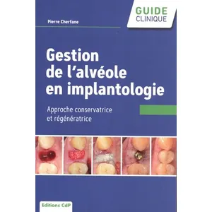 Comparateur de prix : Cdp Gestion de l'alvéole en implantologie