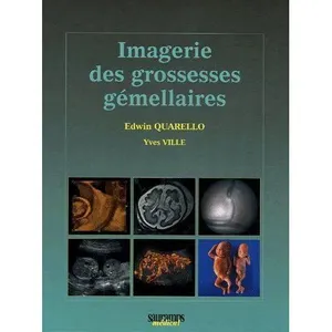 Comparateur de prix : Sauramps Medical Imagerie des grossesses gemellaires