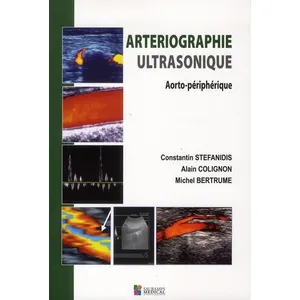 Sauramps Medical Arteriographie ultrasonique pas cher