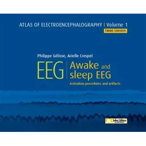 John Libbey Eurotext Atlas of electroencephalography - Volume 1 pas cher