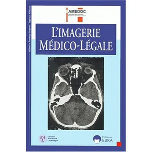 ESKA Imagerie medicolegale pas cher