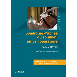 Arnette Syndrome d'apnée du sommeil en périopératoire pas cher