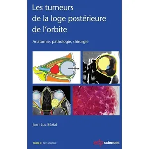 Edp Sciences Les tumeurs de la loge postérieure de l'orbite - Tome 2Vendu paramazon