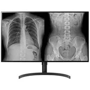 LG 32HL512D-B écran plat de PC 80 cm (31.5") 3840 x 2160 pixels Full HD Noir