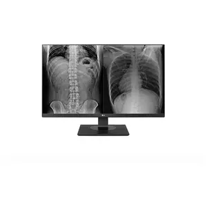 LG 27HJ713C-B 27" LED 4K Ultra HD 14 ms Noir 27HJ713C-BVendu parcdiscount