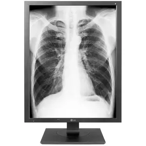 LG Ecran PC 3Mp 21Hk512D 21.3 LED IPS 2K 160Hz HDMI USB NoirVendu parfnac