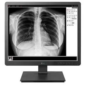 LG 19HK312C 19" LED SXGA 5 ms Noir 19HK312C-B pas cher