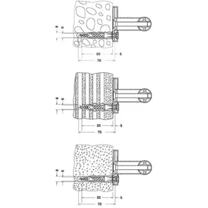 Keuco Kit de fixation n° 1, 34990000100, pas cher