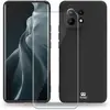 Image de Coque IBROZ Xiaomi Mi 11 Coque noir