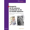 Image de Imagerie de la colonne vertébrale et de la moelle épinière