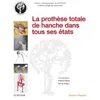 Image de La prothèse totale de hanche dans tous ses états en occasion ou reconditionné