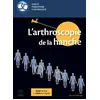 Image de L'arthroscopie de la hanche