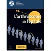Image de L'arthroscopie de l'épaule