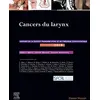 Image de Cancers du larynx: Rapport SFORL 2019