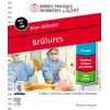 Image de Bien débuter. Brûlures en occasion ou reconditionné