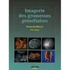 Image de Imagerie des grossesses gemellaires en occasion ou reconditionné