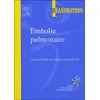 Image de Embolie pulmonaire: Srlf