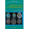 Image de Imagerie du suivi en neuroradiologie en occasion ou reconditionné