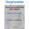 Image de Chirurgie humanitaire. sequelles de brulures chez l enfant en occasion ou reconditionné