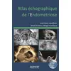 Image de Atlas échographique de l'endométriose en occasion ou reconditionné
