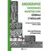Image de Angiographie par résonance magnétique (ARM) cérébrale et médullaire : techniques, indications, résultats, variantes et pièges en occasion ou reconditionné