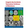 Image de Imagerie des accidents vasculaires cérébraux et médullaires en occasion ou reconditionné