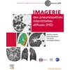 Image de Imagerie des pneumopathies interstitielles diffuses (PID) - Samia Boussouar - Elsevier Masson - broché - Scolaire / Universitaire broché