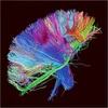 Image de The 2nd law - 2 LP 180g + livret Vinyle album
