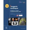 Image de Imagerie cardiaque Jean-Pierre Laissy (Auteur), Professeur Alain Furber (Auteur), Société Française de Cardiologie (SFC) (Auteur), Société Française de Radiologie (Auteur)