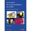 Image de Les tumeurs de la loge postérieure de l'orbite - Tome 2 Jean-Luc Béziat (Auteur)