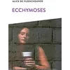 Image de Ecchymoses en occasion ou reconditionné